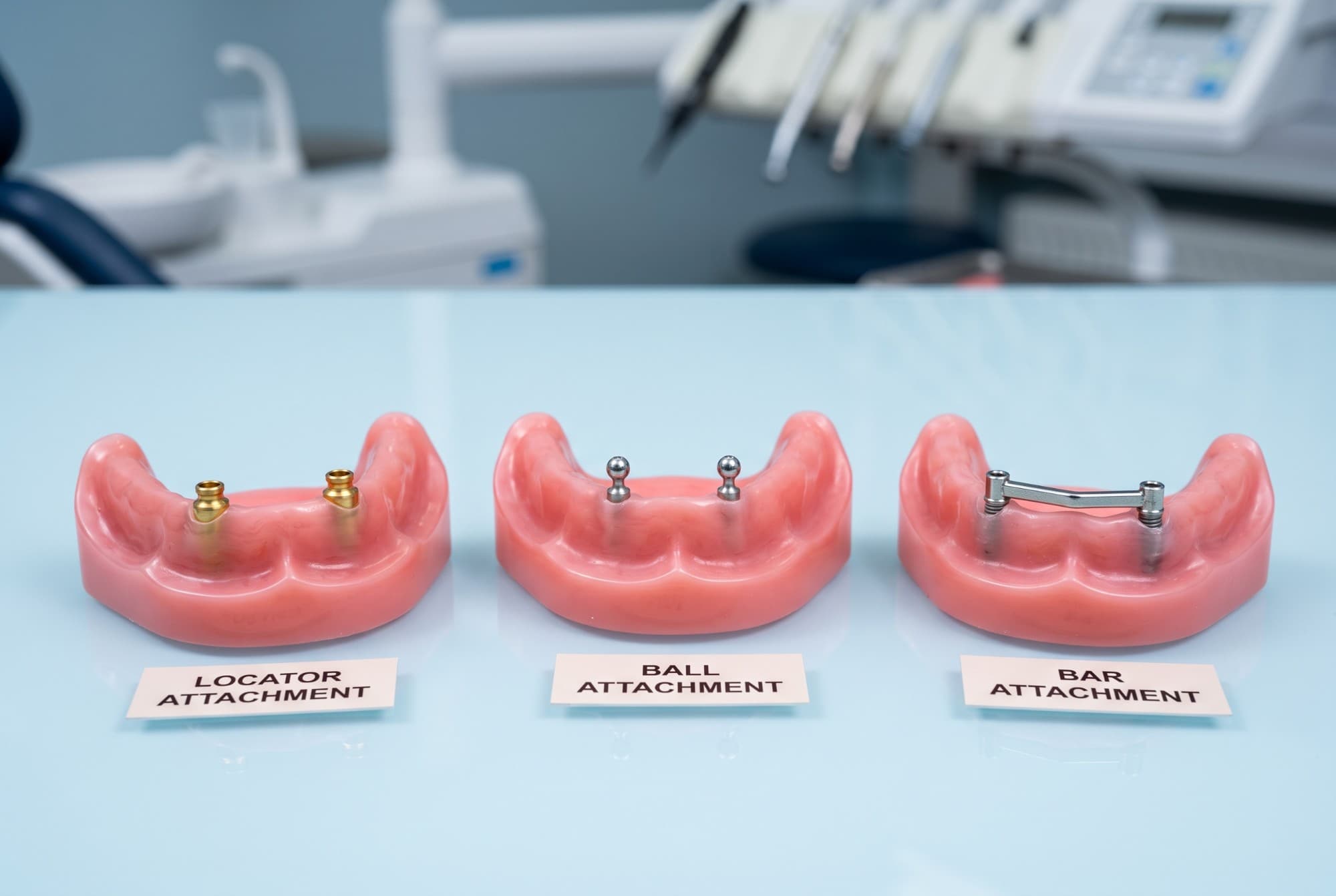 Three denture model casts side by side, each labelled with a different implant overdenture attachment system: locator, ball, and bar